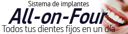 banner sobre sistema de implantes all on four